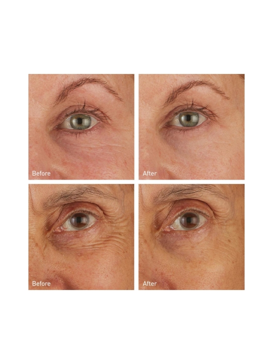 SKYN ICELAND - Hydro Cool Firming Eye Gels -silmänympärysnaamiot 8 paria - photo 4 SKYN ICELAND - Hydro Cool Firming Eye Gels -silmänympärysnaamiot 8 paria | Stockmann - photo 4
