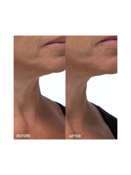 SKYN ICELAND - Hydro Cool Firming Neck Gels -silottavat kaulanaamiot 4kpl - photo 4 SKYN ICELAND - Hydro Cool Firming Neck Gels -silottavat kaulanaamiot 4kpl | Stockmann - photo 4