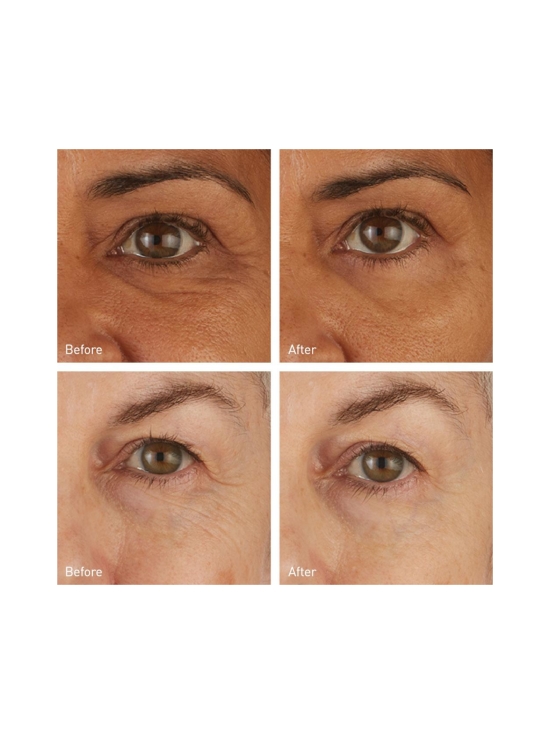 SKYN ICELAND - Hydro Cool Firming Eye Gels -silmänympärysnaamiot 8 paria - photo 3 SKYN ICELAND - Hydro Cool Firming Eye Gels -silmänympärysnaamiot 8 paria | Stockmann - photo 3