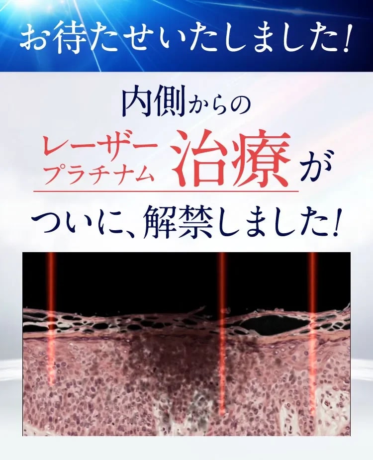 内側からのレーザープラチナム治療