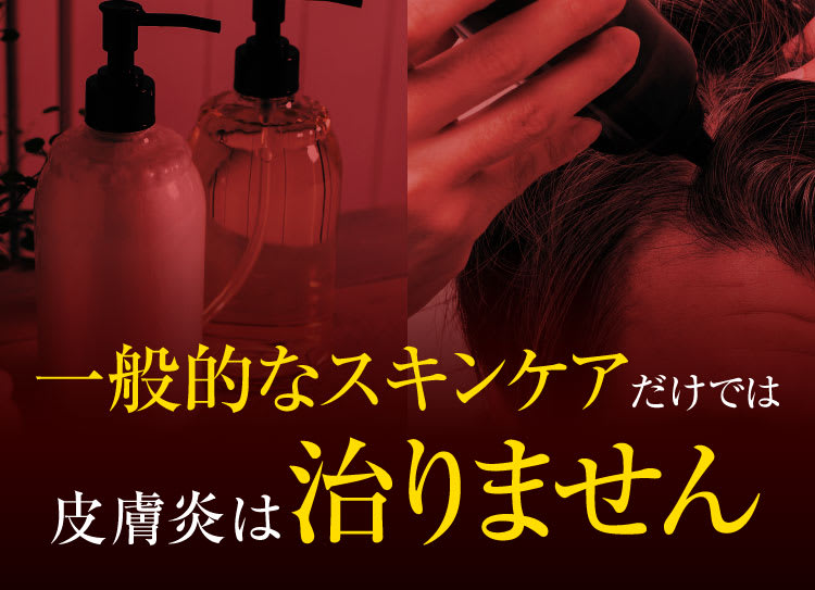 セクション22｜ポテンツァ錠0