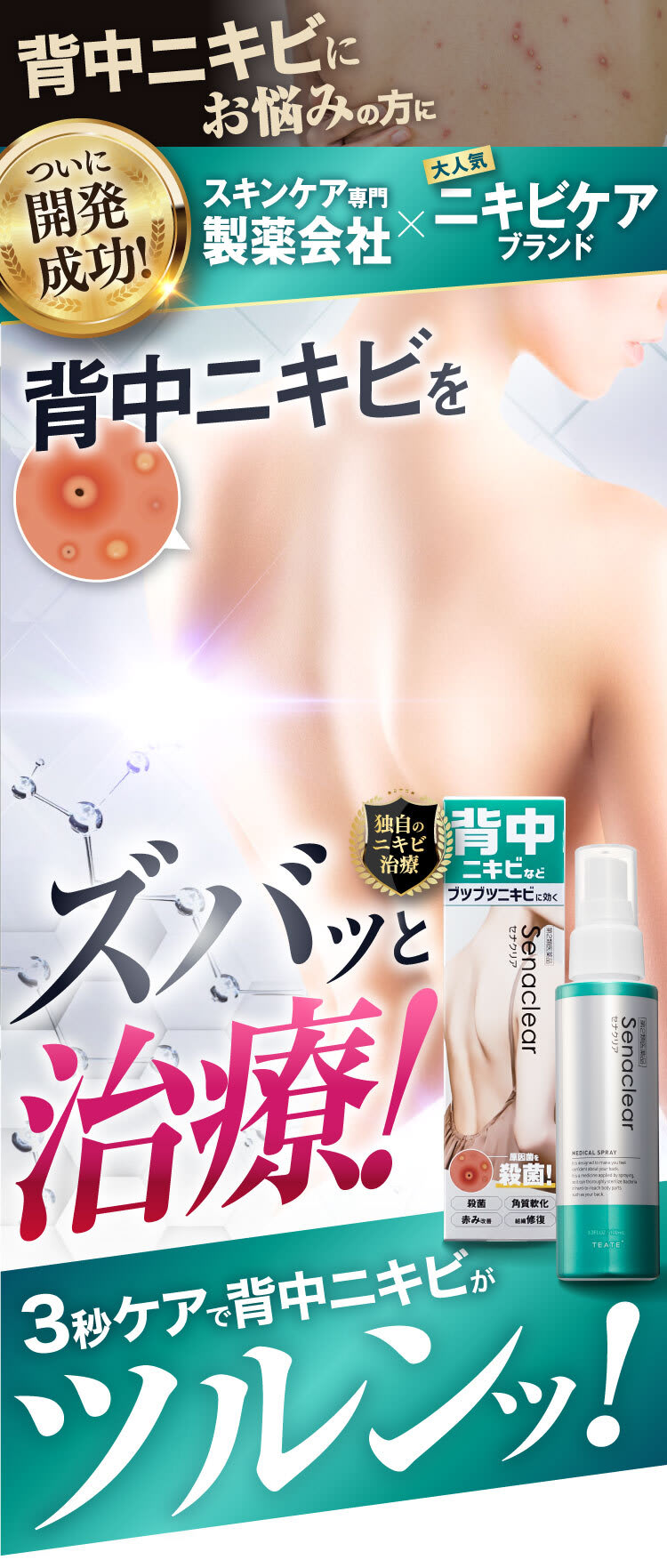 背中ニキビをズバッと治療