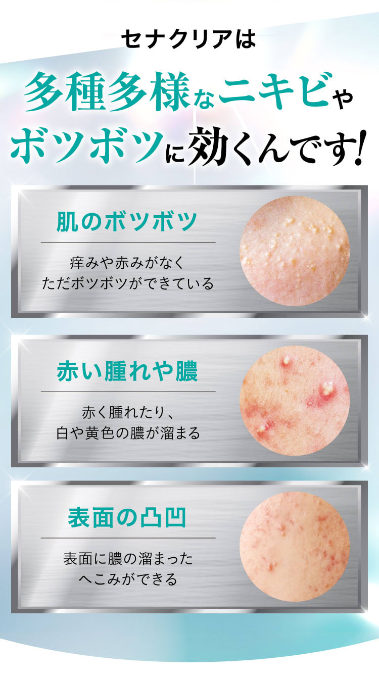 セナクリアは多種多様なニキビやボツボツに効くんです！