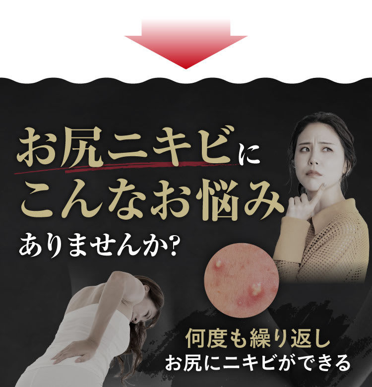 お尻ニキビにこんなお悩みありませんか？