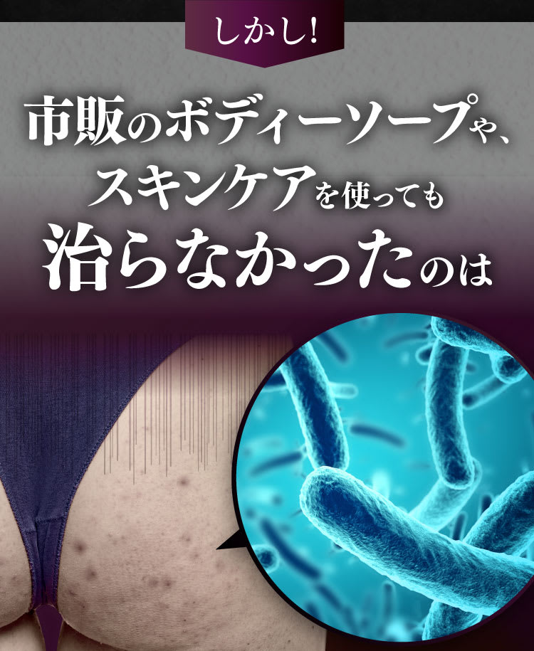 市販のボディーソープやスキンケアを使っても治らなかったのは
