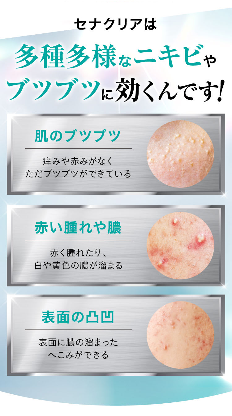 セナクリアは多種多様なニキビやブツブツに効くんです！