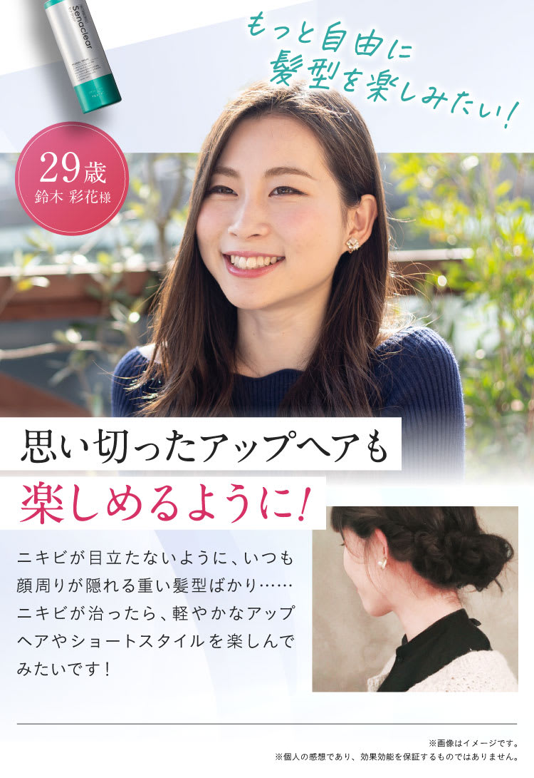 思い切ったアップヘアも楽しめるように！