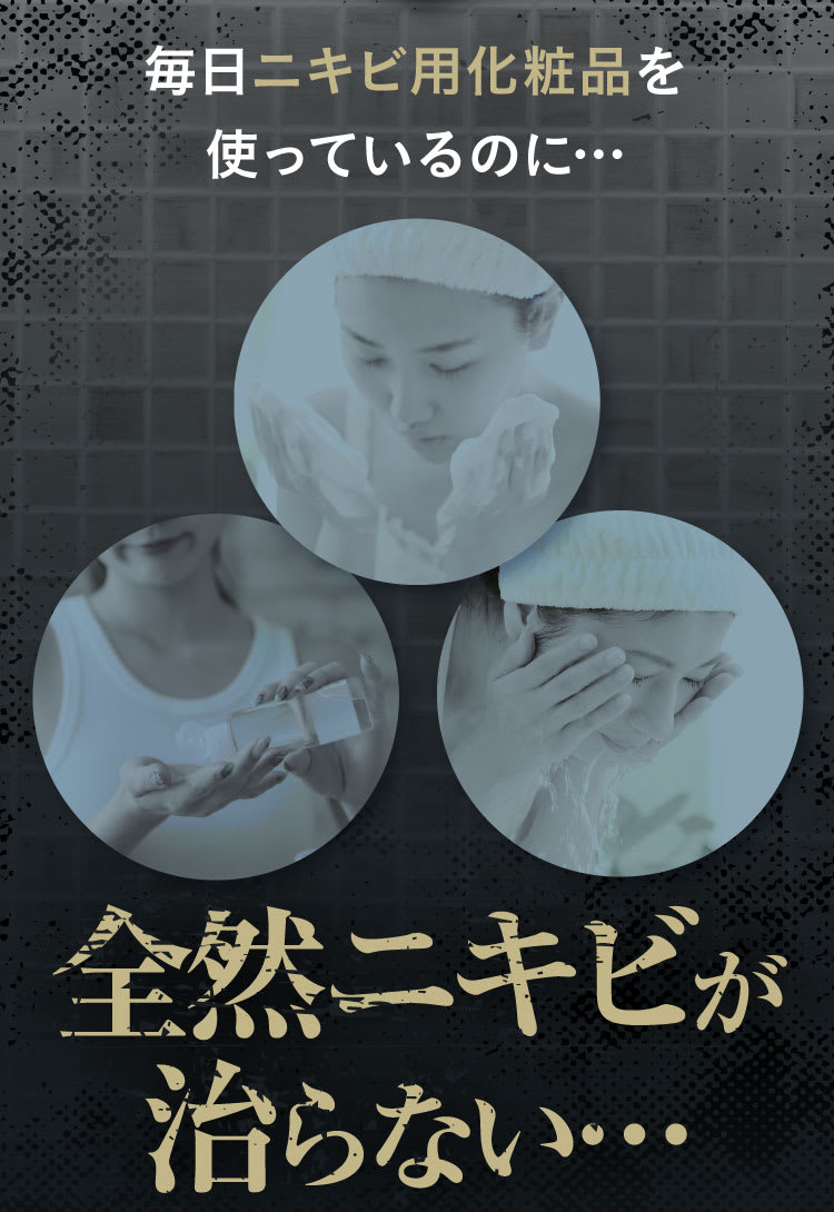 全然ニキビが治らない・・・