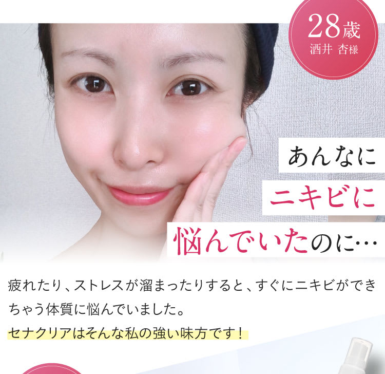 あんなにニキビに悩んでいたのに・・・