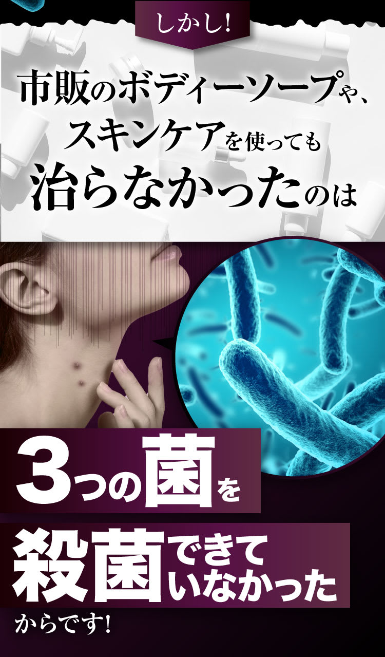 市販のボディーソープやスキンケアを使っても治らなかったのは