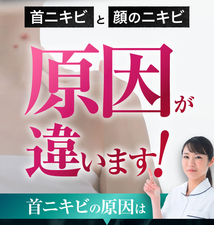 首ニキビと顔ニキビ