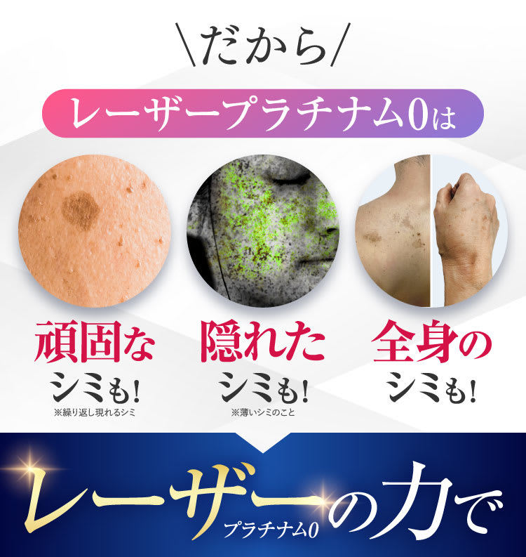 どんなシミもレーザーの力で…
