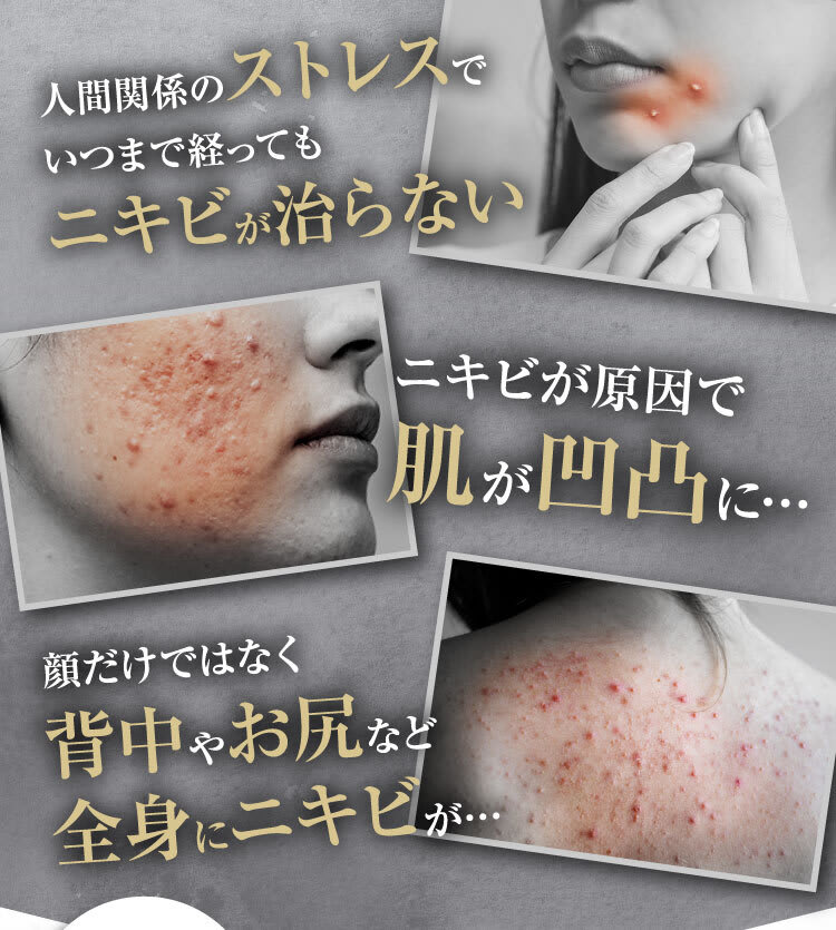 人間関係のストレス｜ポテンツァ錠0