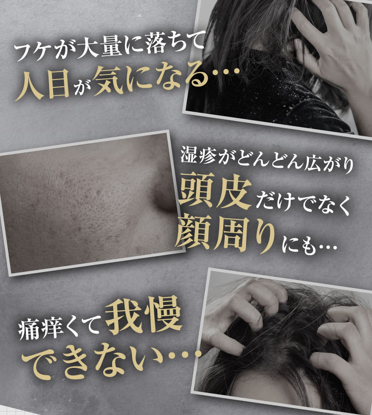 フケが大量に落ちて人目が気になる・・・｜ポテンツァ錠0