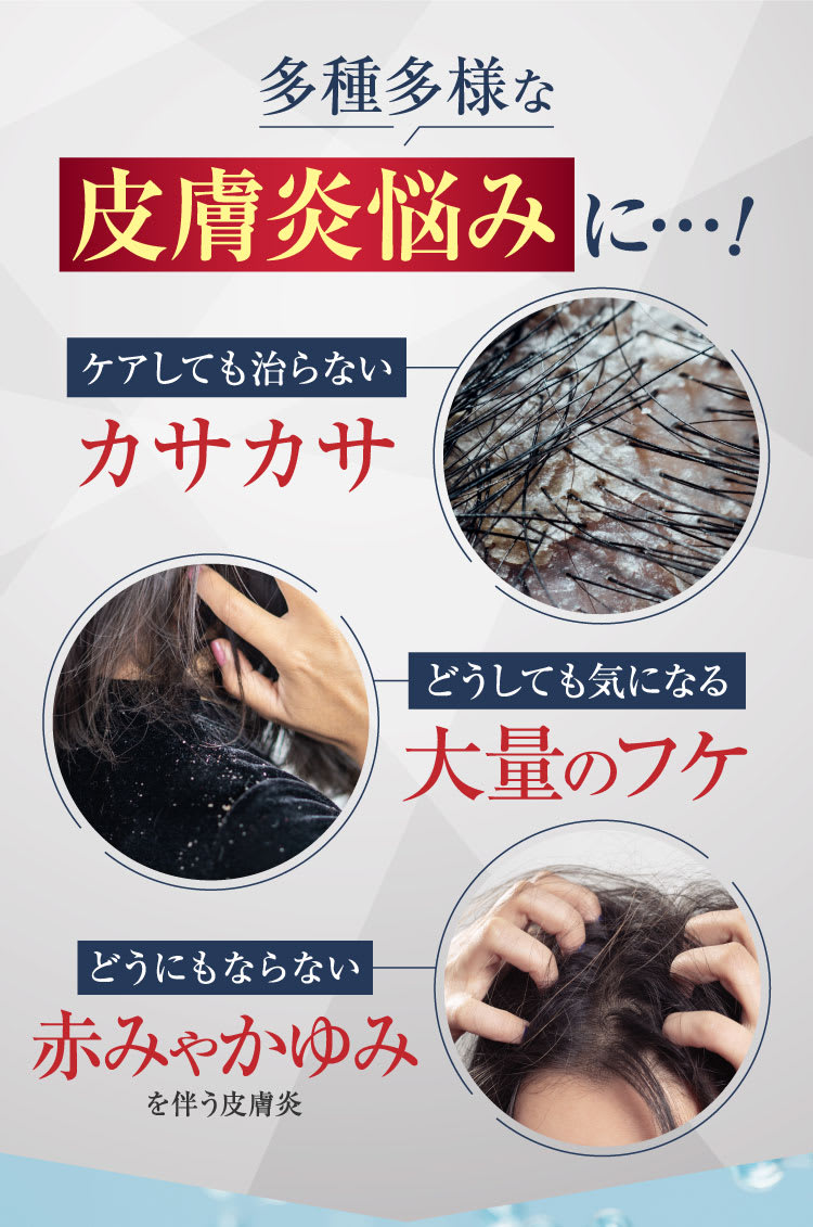 多種多様なニキビの悩みに｜ポテンツァ錠0