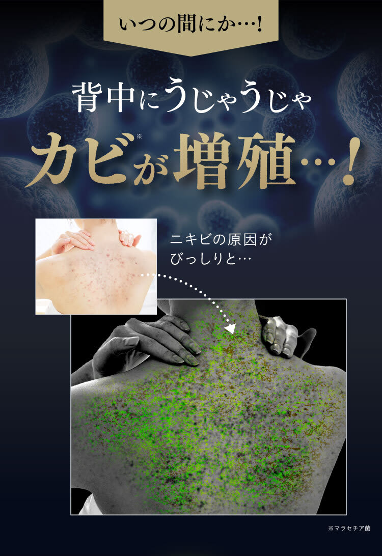 背中にうじゃうじゃカビが増殖
