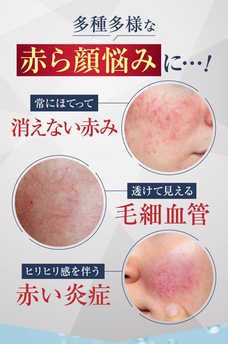 多種多様な赤ら顔の悩みに｜ポテンツァ錠0