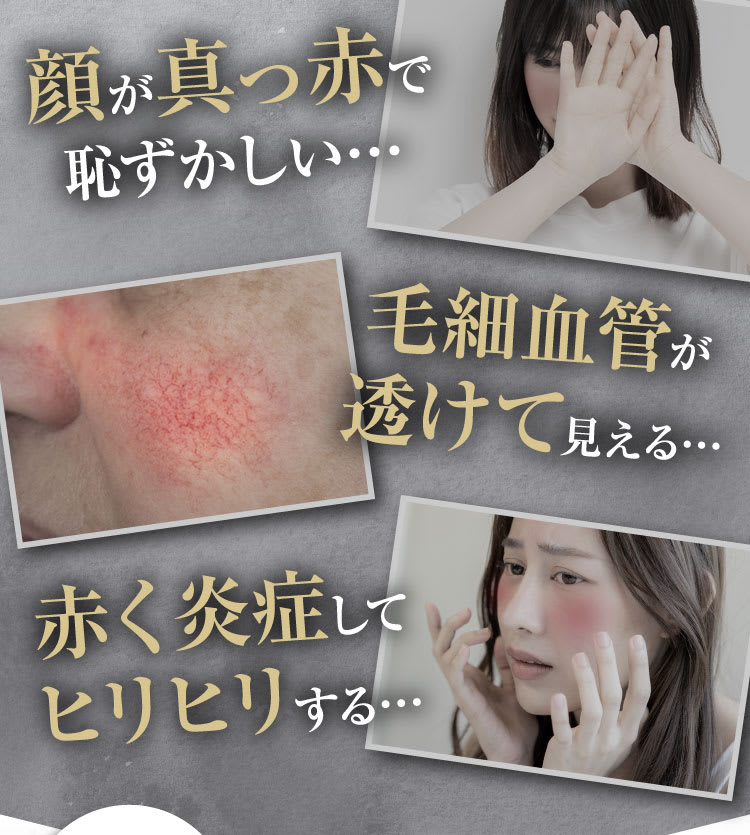 顔が真っ赤で恥ずかしい｜ポテンツァ錠0