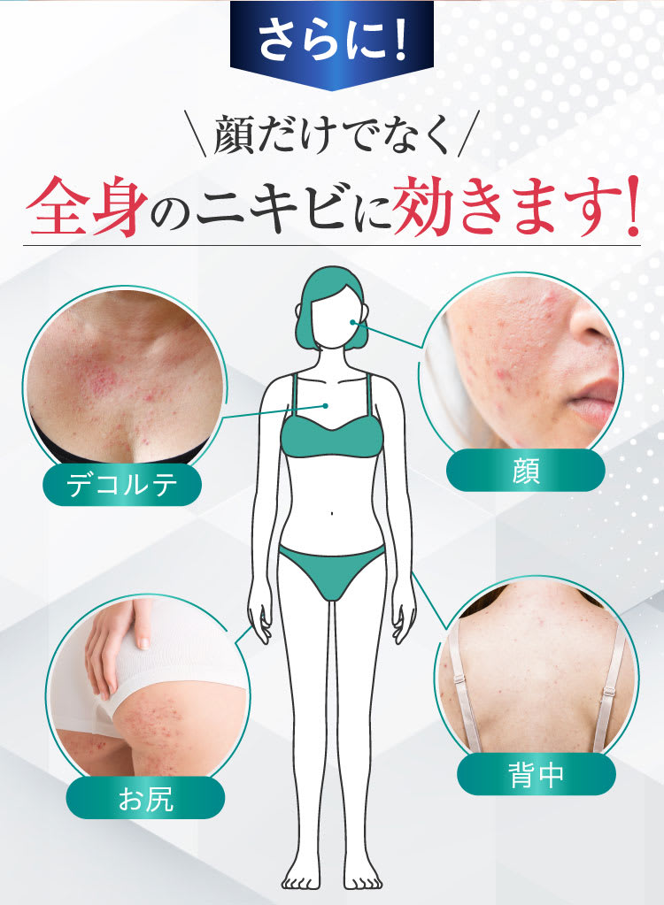 さらに！顔だけでなく全身のニキビにも効きます！｜ポテンツァ錠0