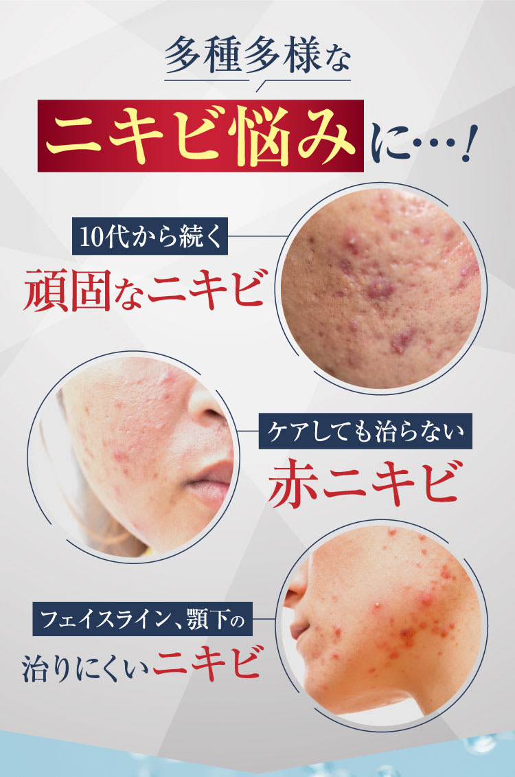多種多様なニキビの悩みに｜ポテンツァ錠0