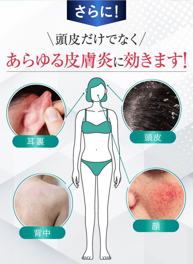 さらに！頭皮だけでなくあらゆる皮膚炎にも効きます！｜ポテンツァ錠0