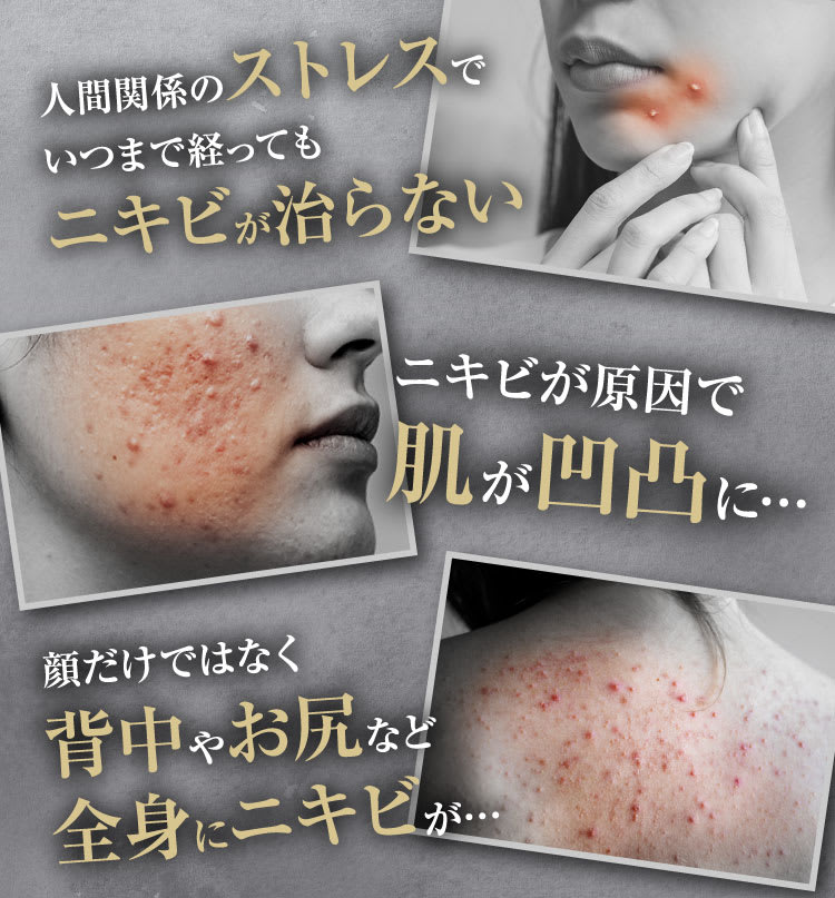 人間関係のストレス｜ポテンツァ錠0