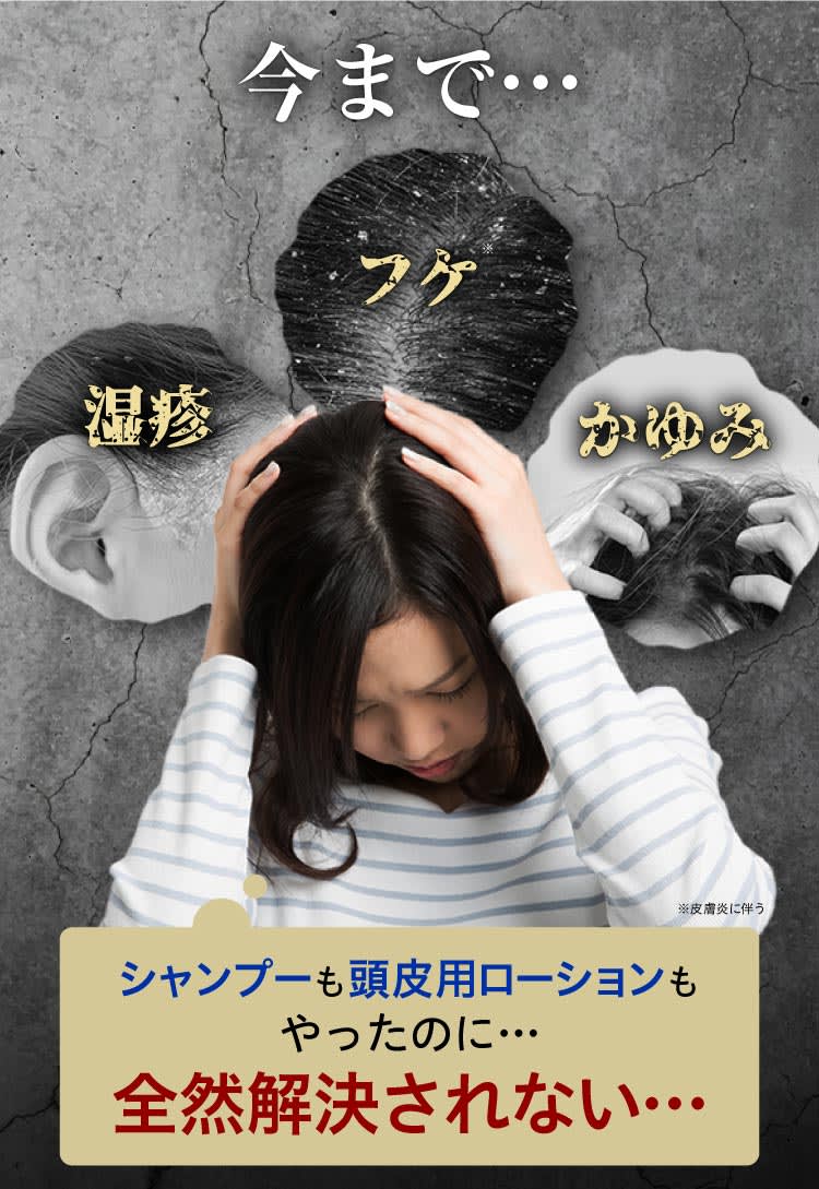 今まで何やっても改善しなかった｜ポテンツァ錠0