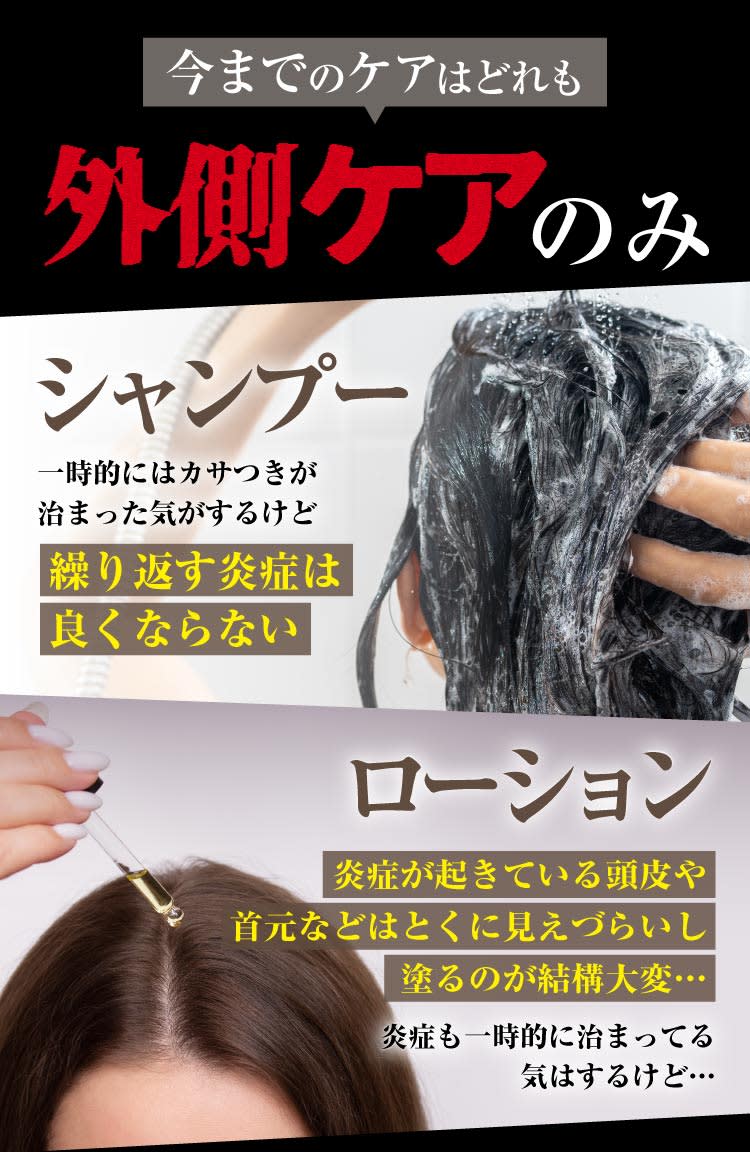 外側ケアのみ｜ポテンツァ錠0