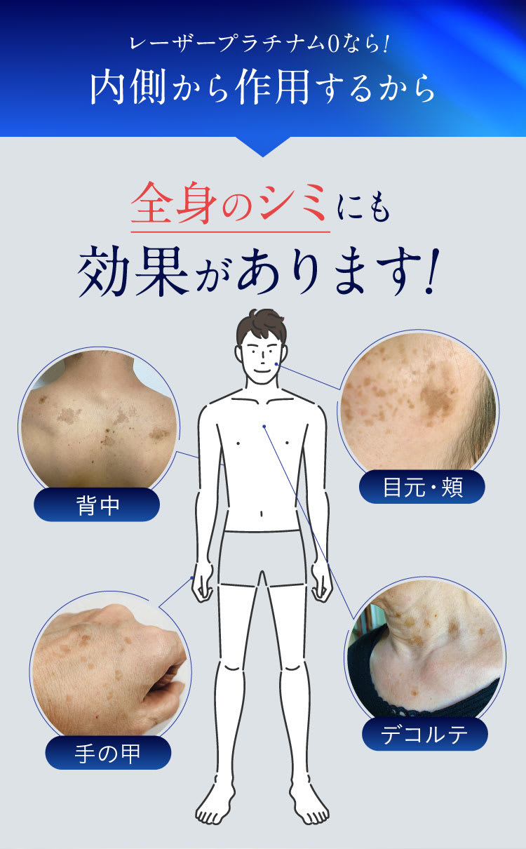 全身のシミにも効果があります