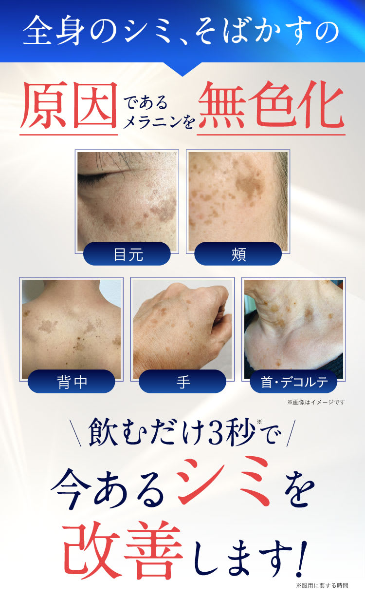 全身のシミそばかすを無色化