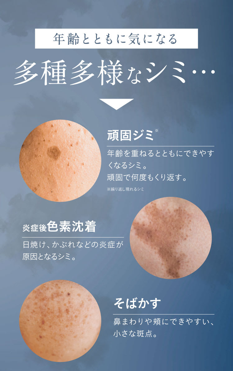 多種多様なシミ
