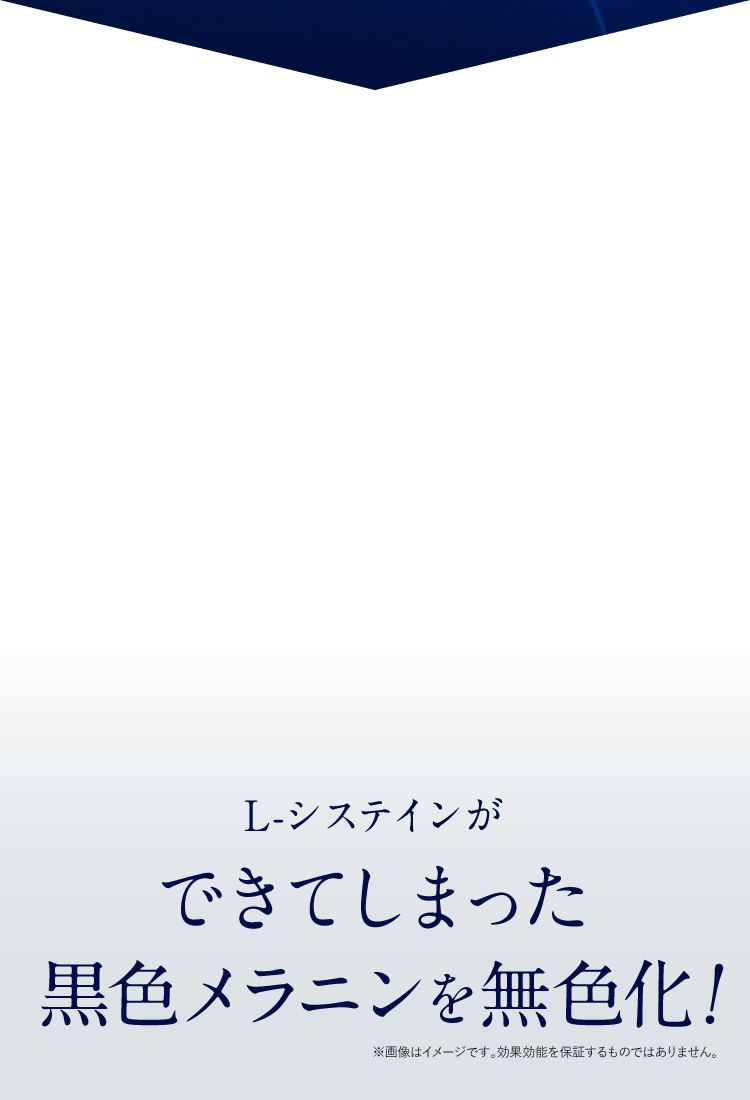 レーザープラチナムはできてしまった黒色メラニンを無色化!