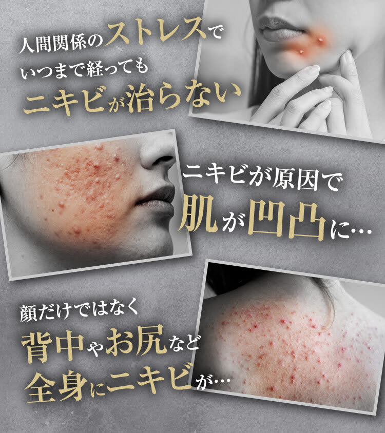 人間関係のストレス｜ポテンツァ錠0