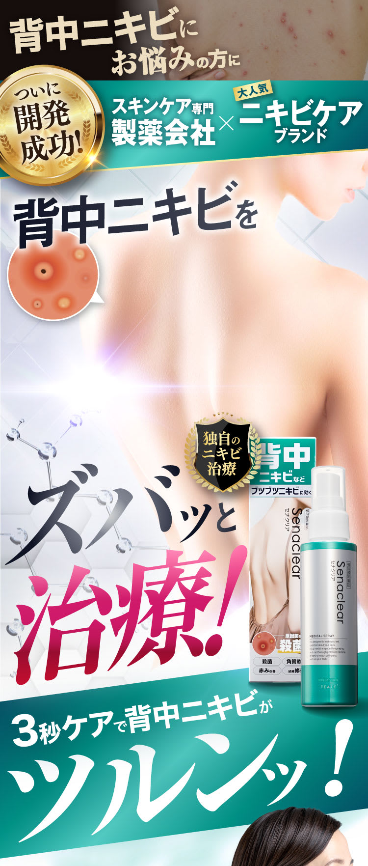 背中ニキビをズバッと治療