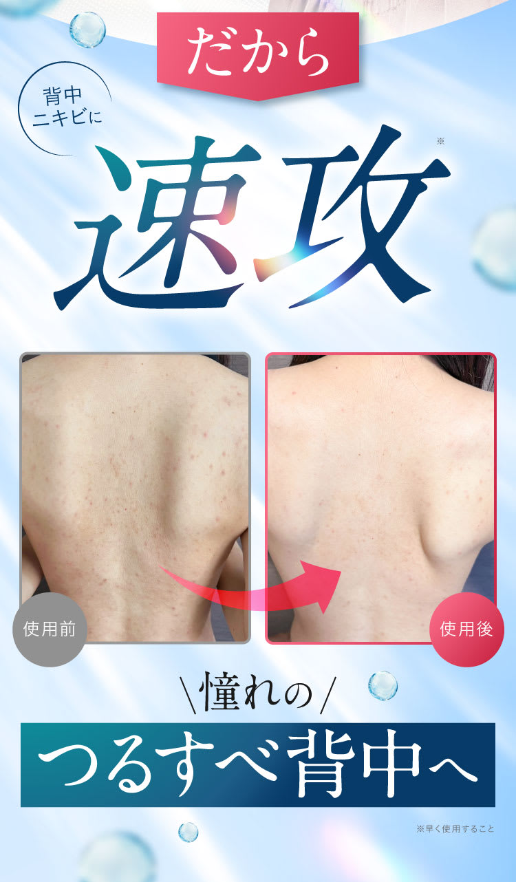 速攻