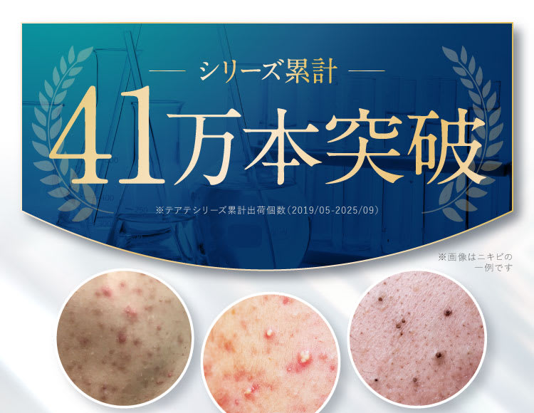 史上初|セナクリア