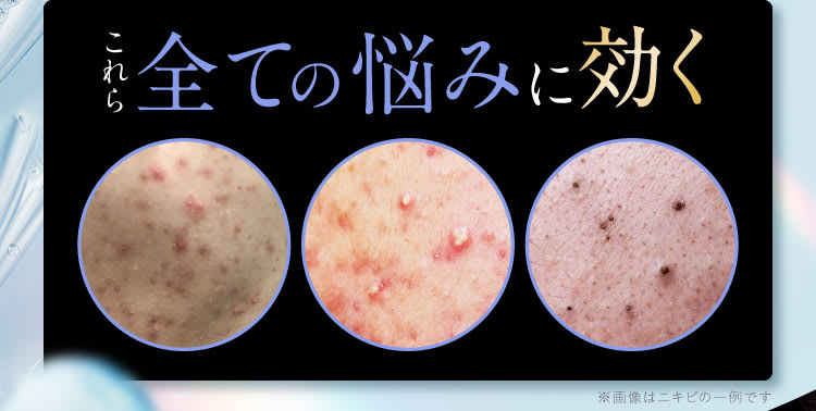 史上初|セナクリア