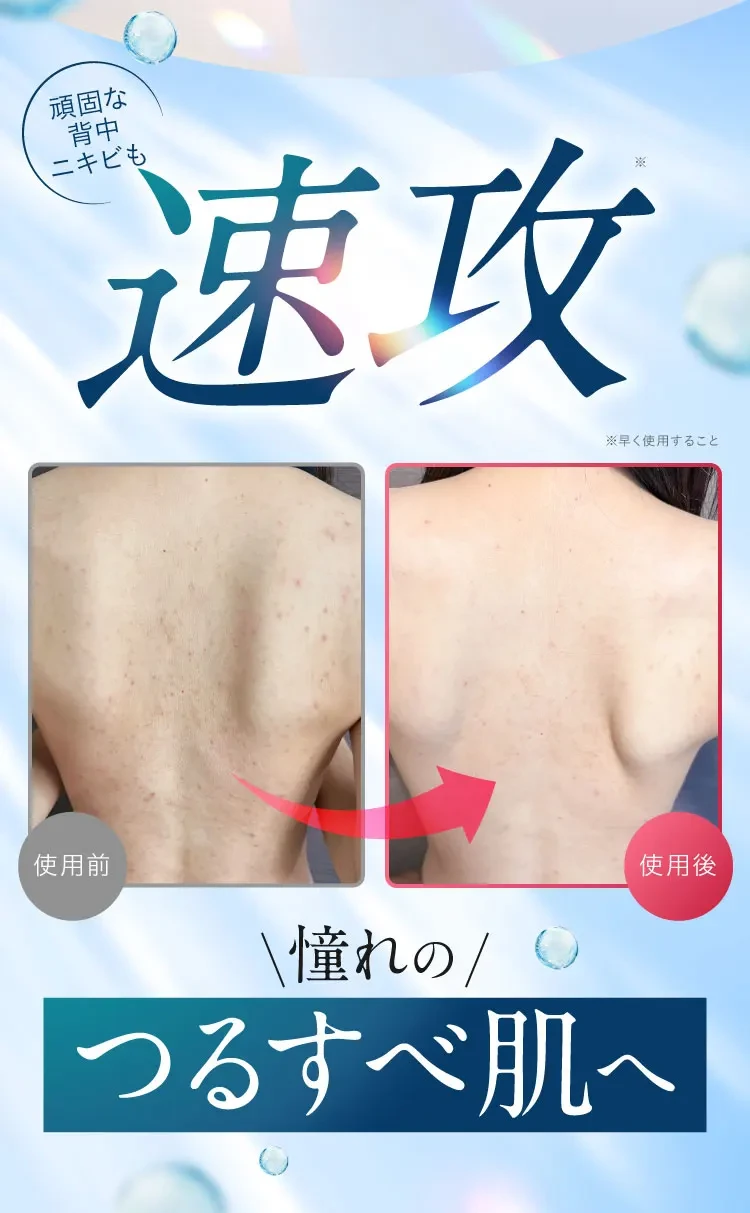 速攻