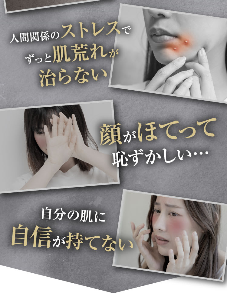 人間関係のストレス｜ポテンツァ錠0