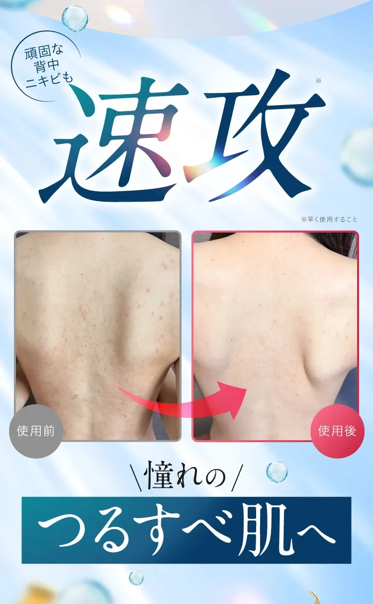 速攻