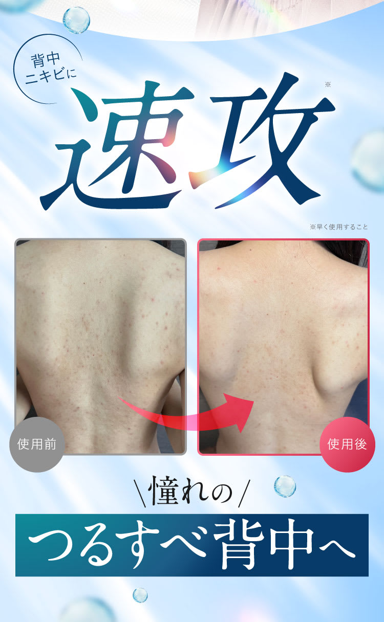 速攻