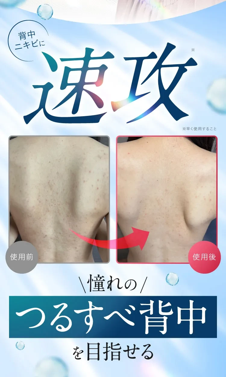速攻