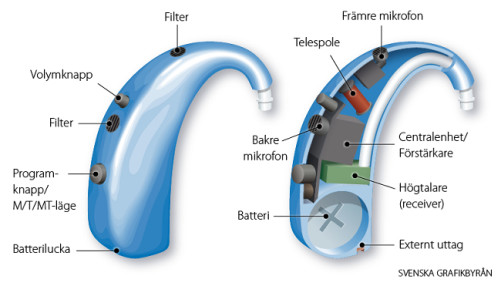 Schematisk bild av hörapparat och de ingående delarna.