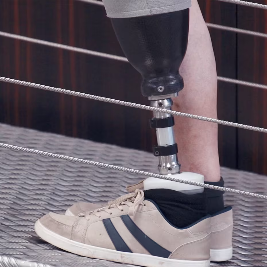 Detailní záběr na nohu uživatele, který stojí s protézovým chodidlem Meridium na rampě.