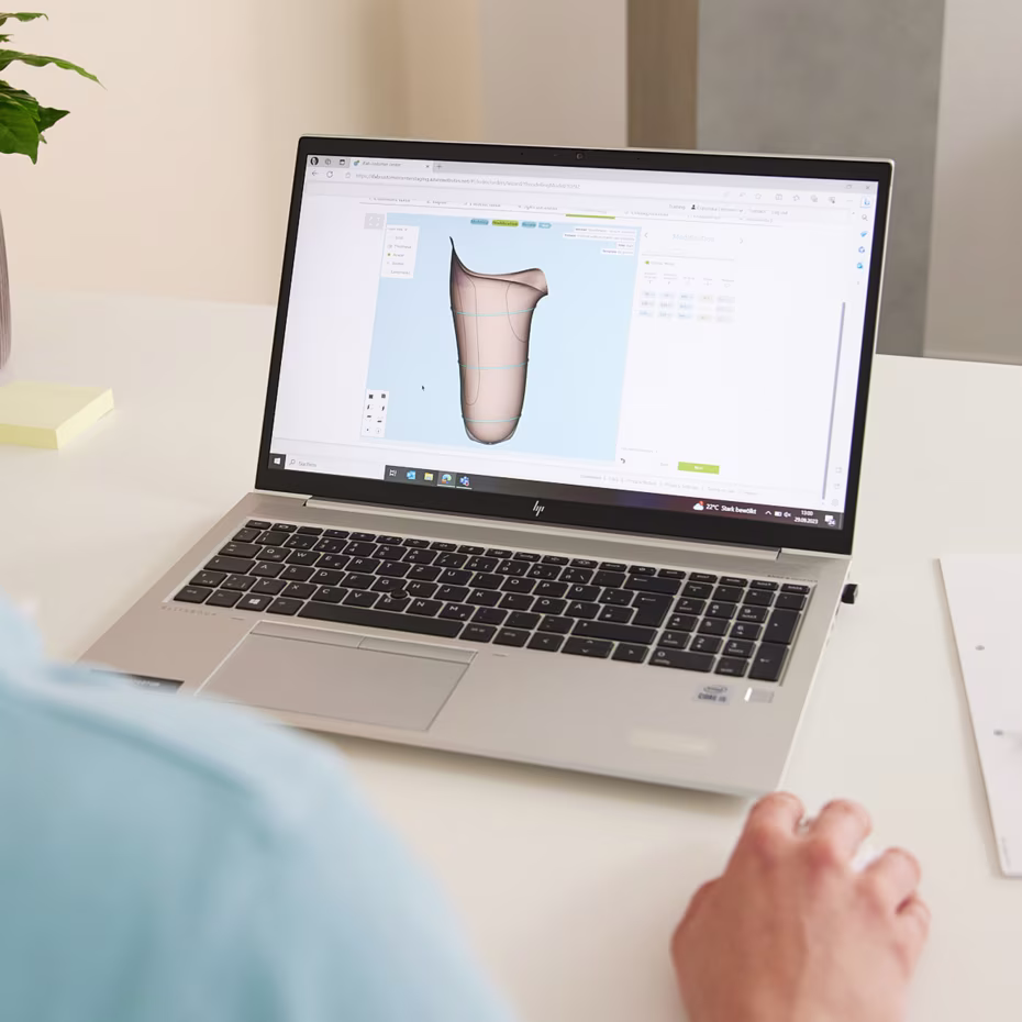 Over-the-shoulder view of CPO, using Ottobock MyFit TF software on laptop. 