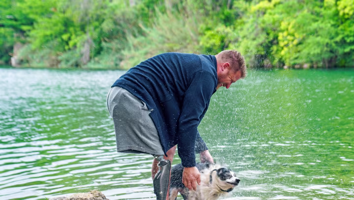 A C-Leg user pets his wet dog close to a lake.