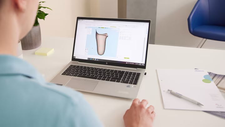 CPO and patient in patient care center with Ottobock MyFit TF test socket.