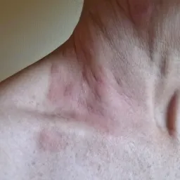 Commenter la photo 10