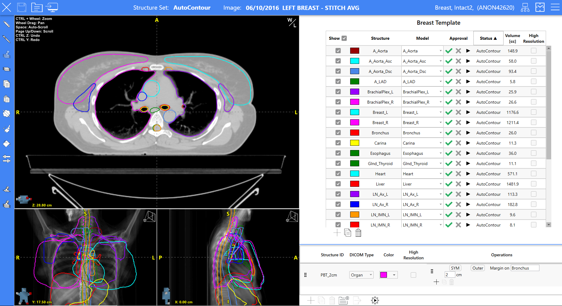 Dosimetry Systems & QA Tools