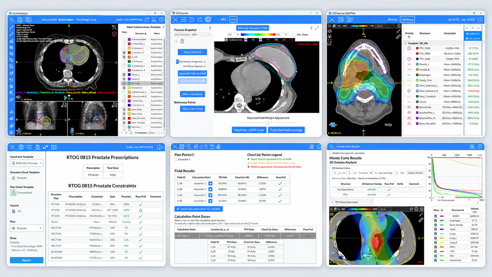 Automation Across the Radiotherapy Workflow